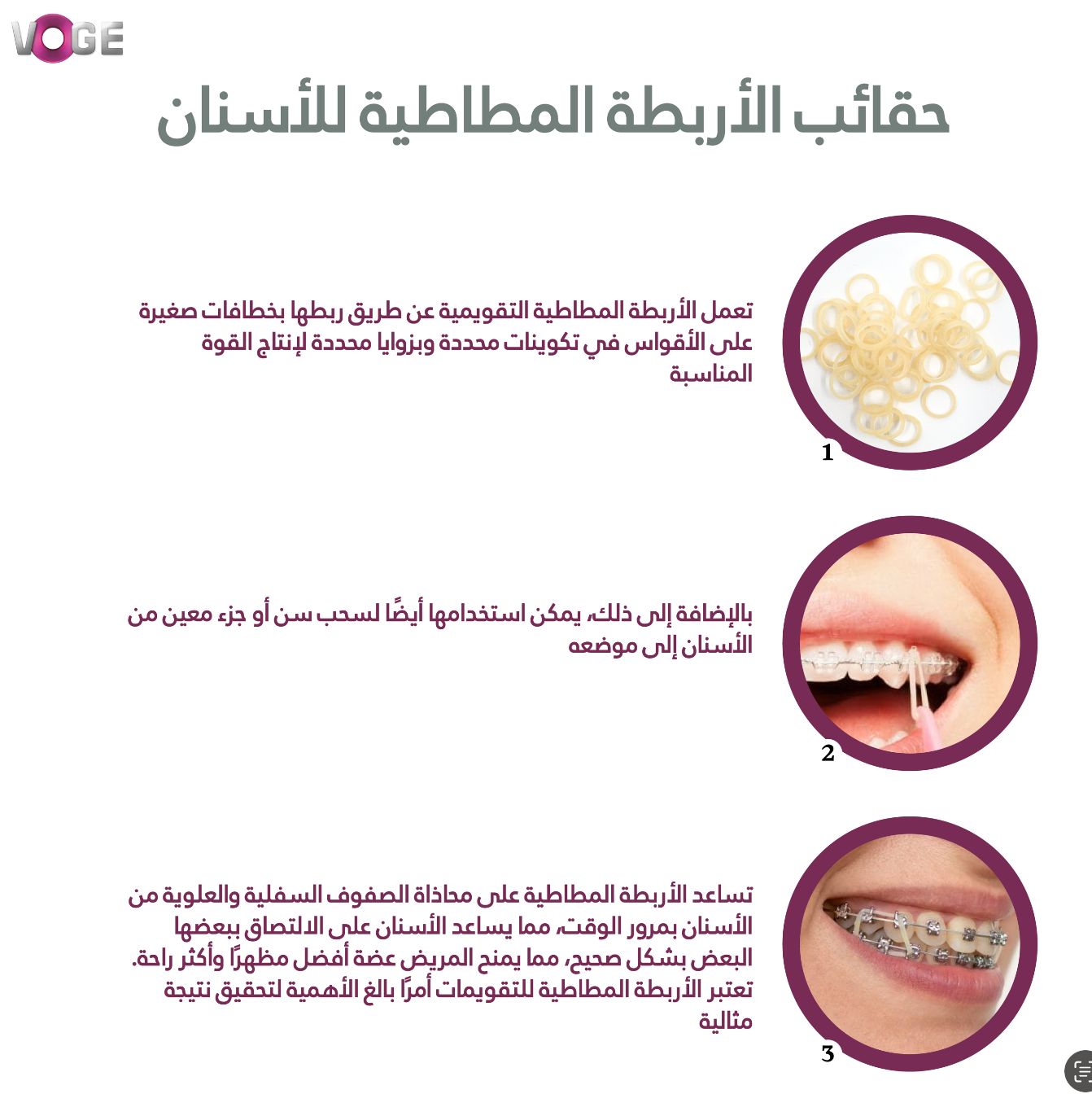 Elastic orthodontic bands