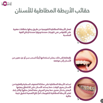 Elastic orthodontic bands